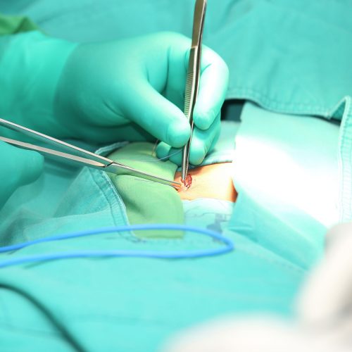 Chirurgia della parete addominale Chirurgia della parete addominale